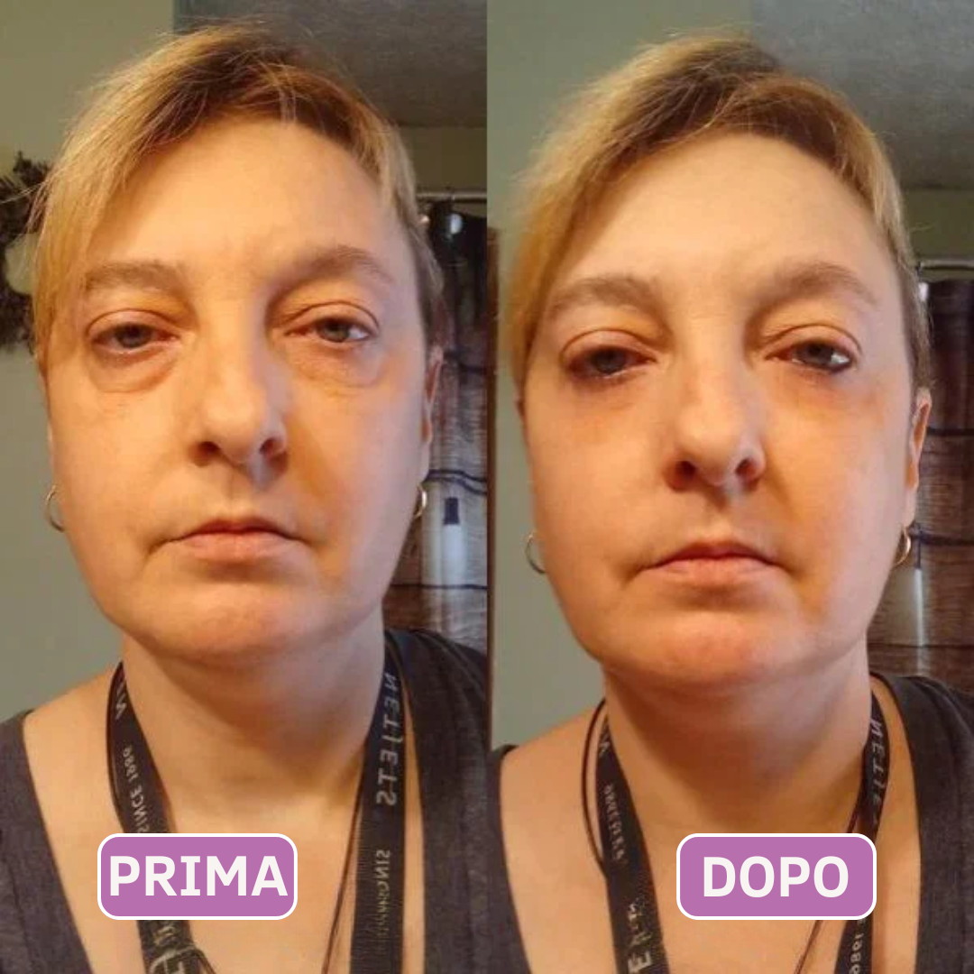 Patch occhi al collagene e peptidi