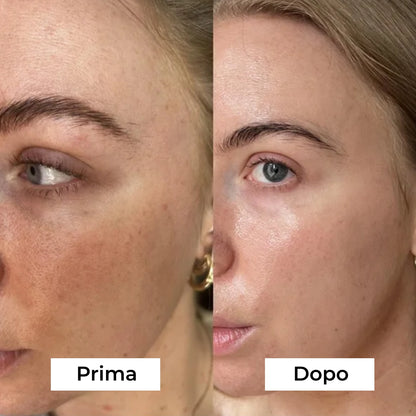 Maschera Peel Off al Bio-Collagene