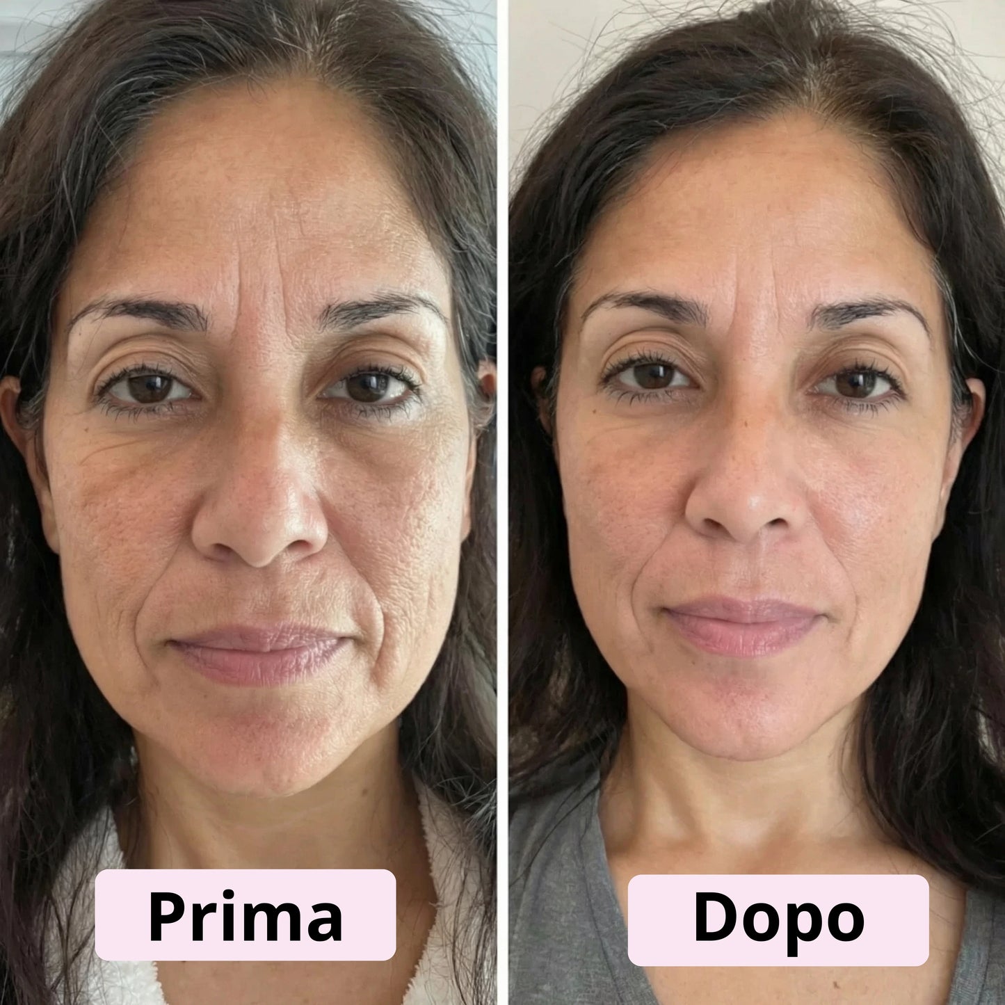 Siero in Capsule al PDRN e Acido Ialuronico