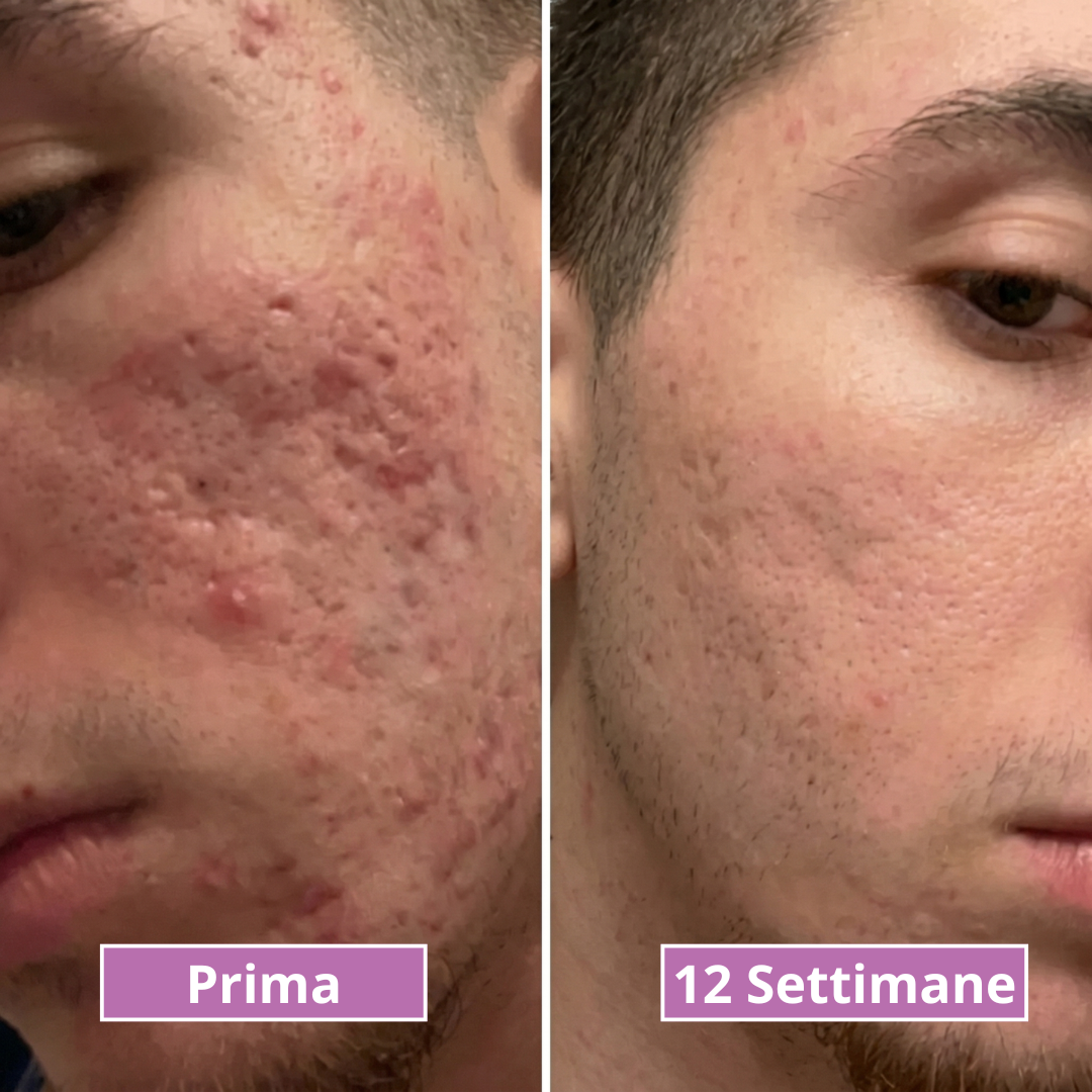 Pure Collagen Stick