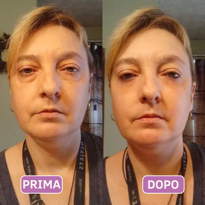 Patch occhi al collagene e peptidi