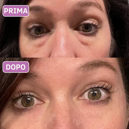 Patch occhi al collagene e peptidi