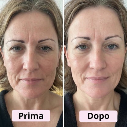 Siero in Capsule al PDRN e Acido Ialuronico