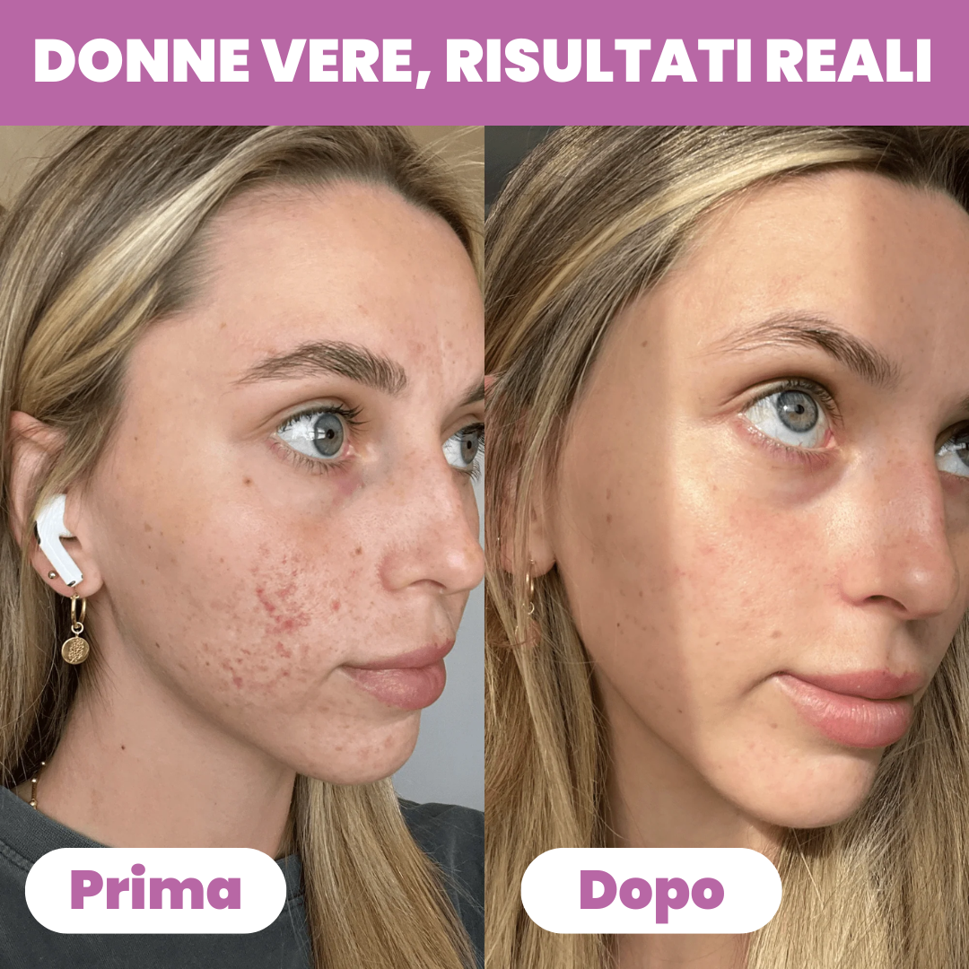 Gel al Collagene Idrolizzato