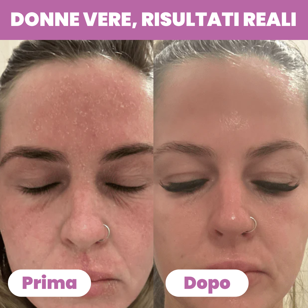 Gel al Collagene Idrolizzato