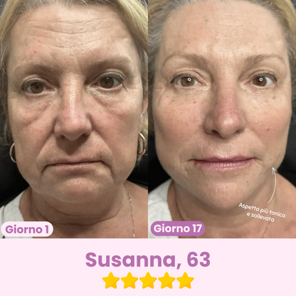 Maschera Lifting in Retinolo