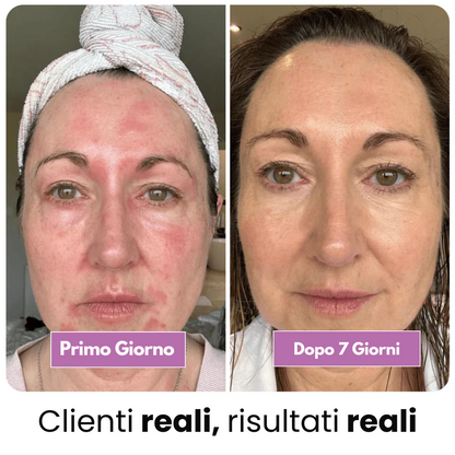 Stick al Collagene Puro